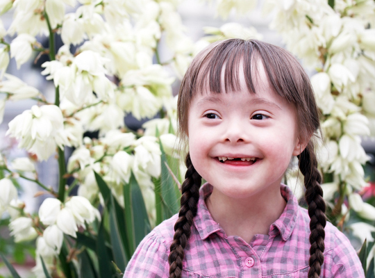 Down Syndrome